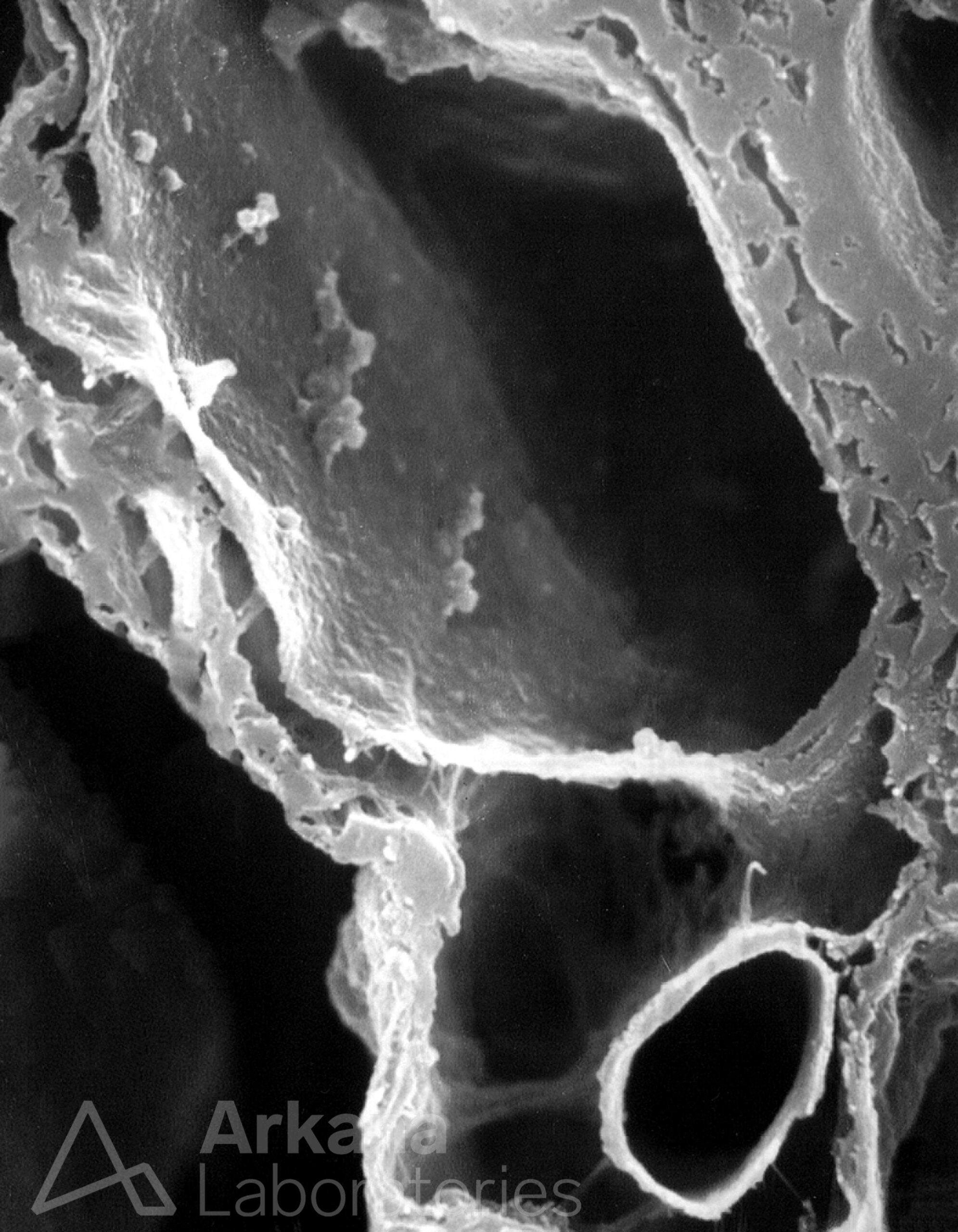 Glomerular Basement Membrane