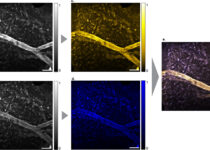 dual color autofluorescence visualization