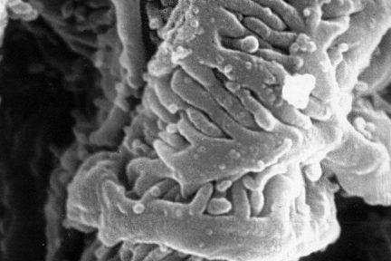 interdigitating podocyte foot processes