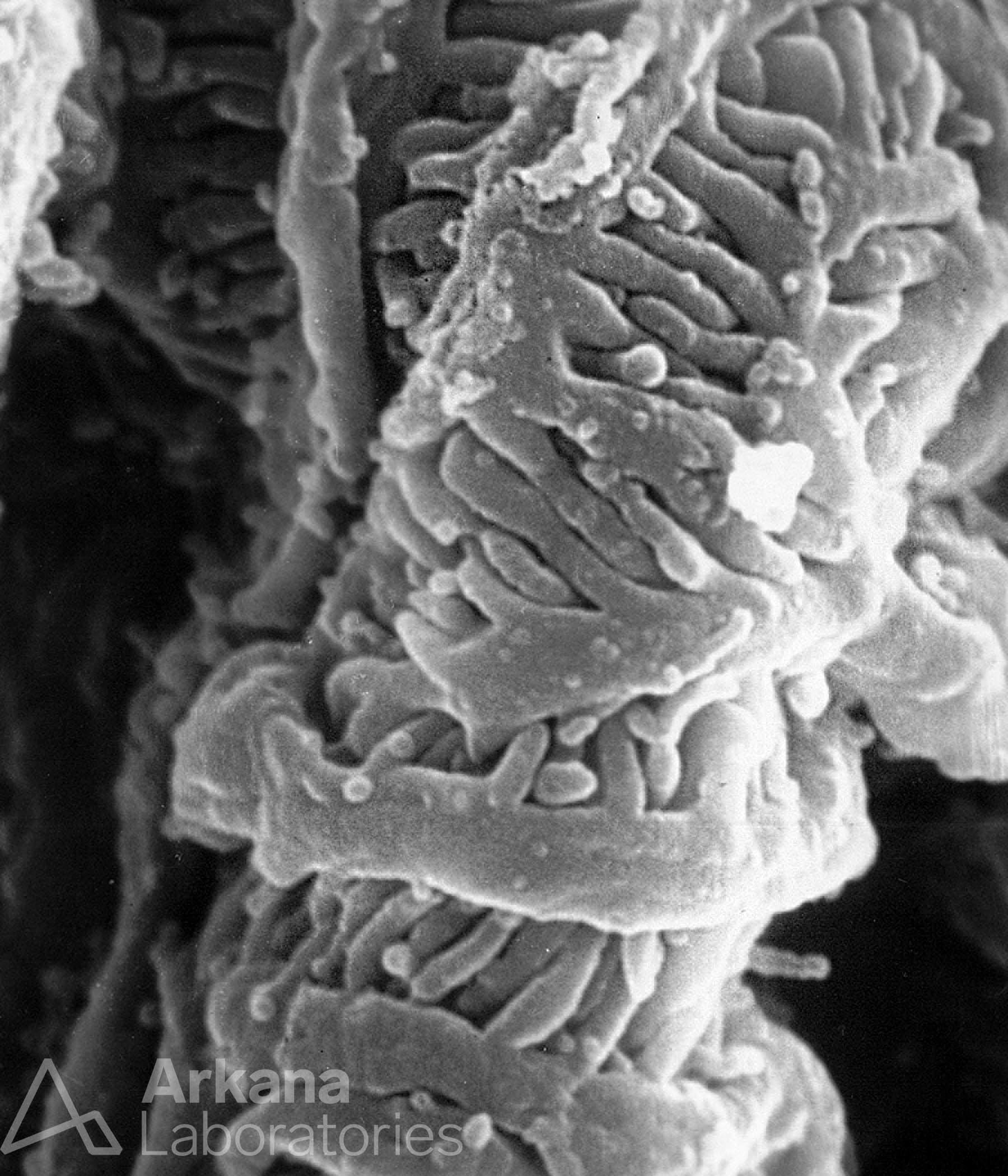 interdigitating podocyte foot processes