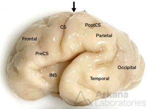 Fetal Brain