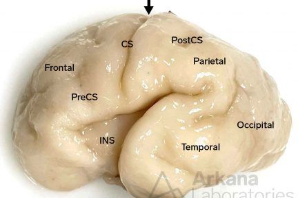 Fetal Brain