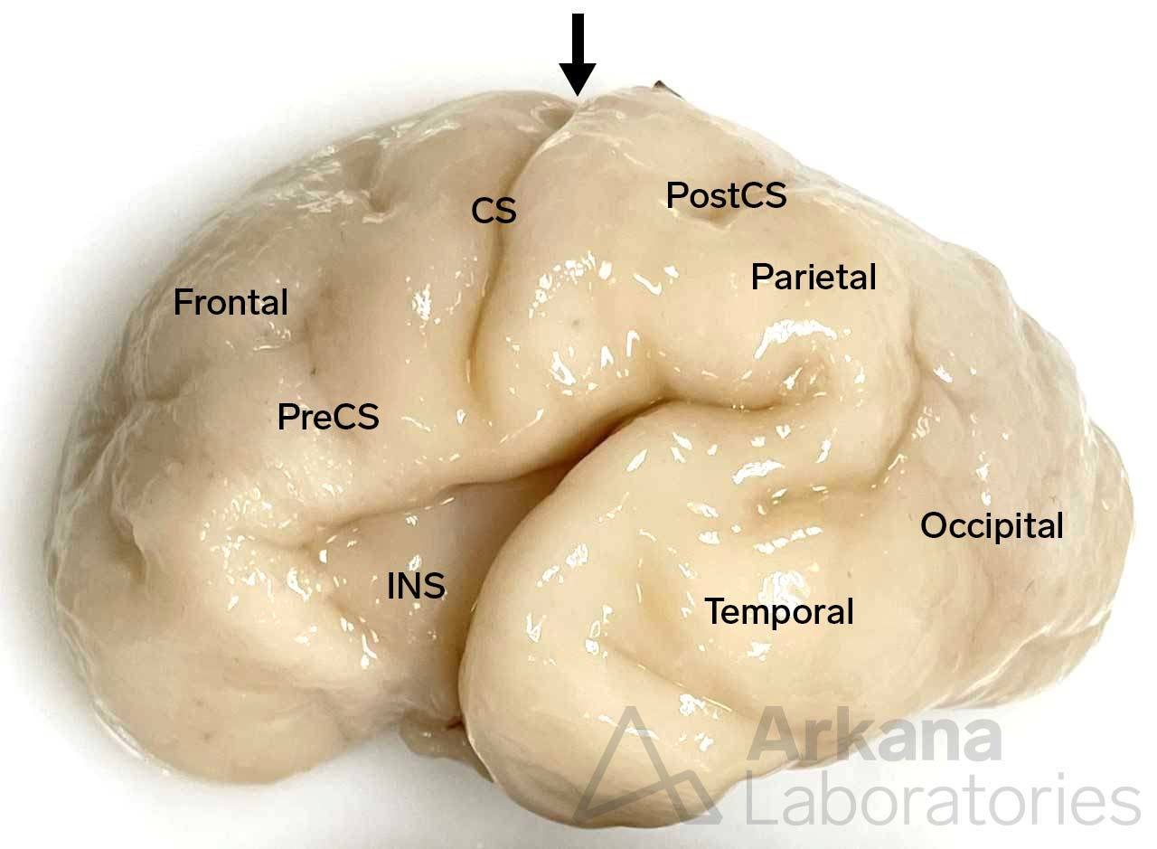 Fetal Brain