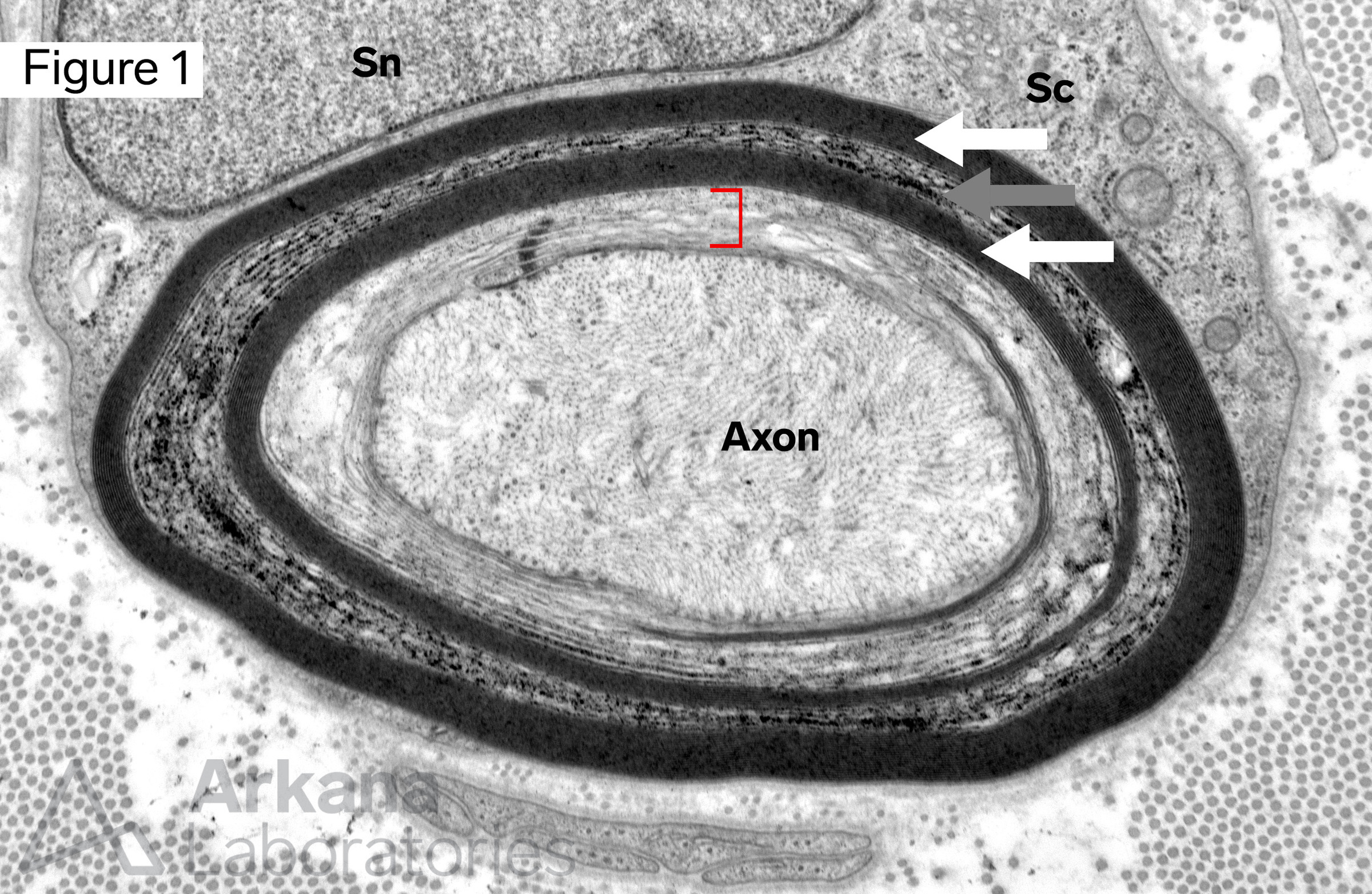 axon, Myelin incisure, Schmidt-Lanterman Incisure, myelin sheath