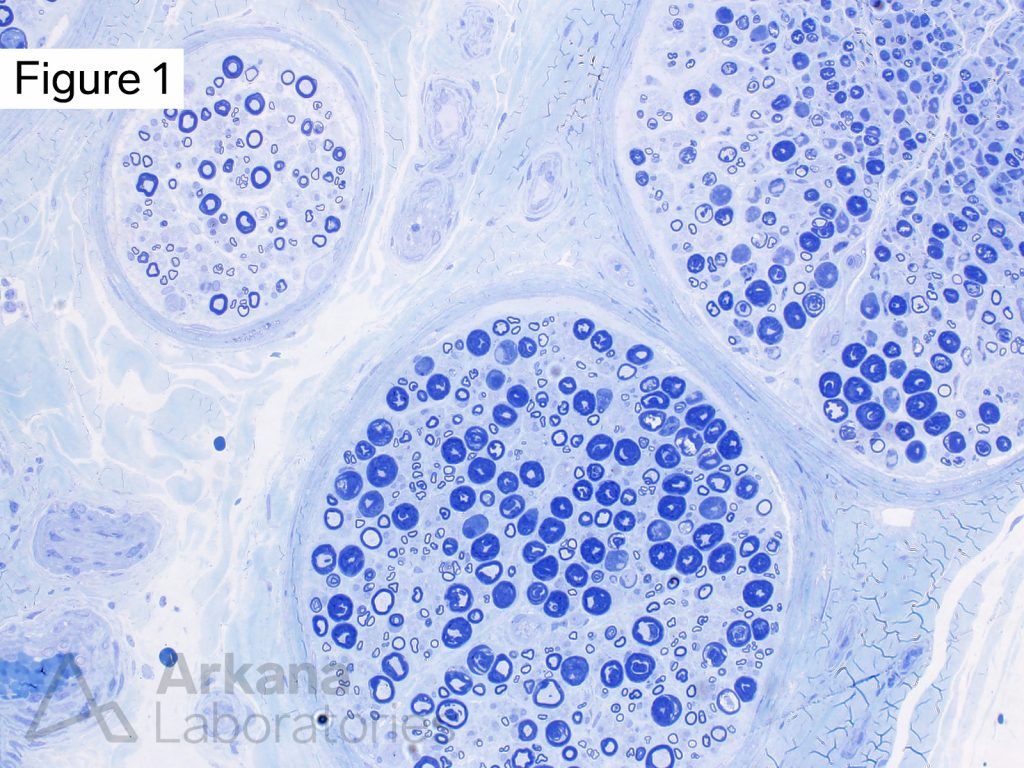 Toluidine Blue Stained Thick Section Neuro Notes Arkana Labs colour-run-medal