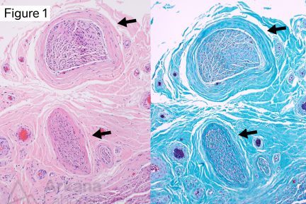 Microfascicles