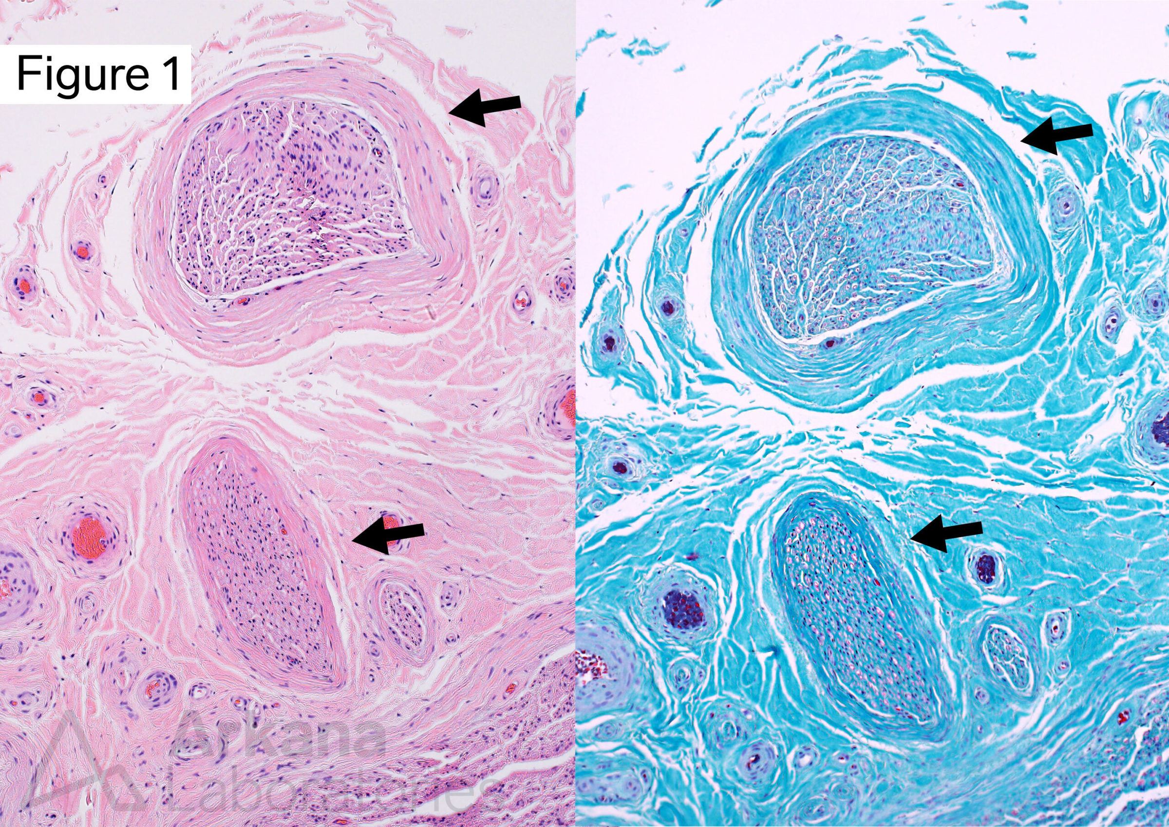 Microfascicles