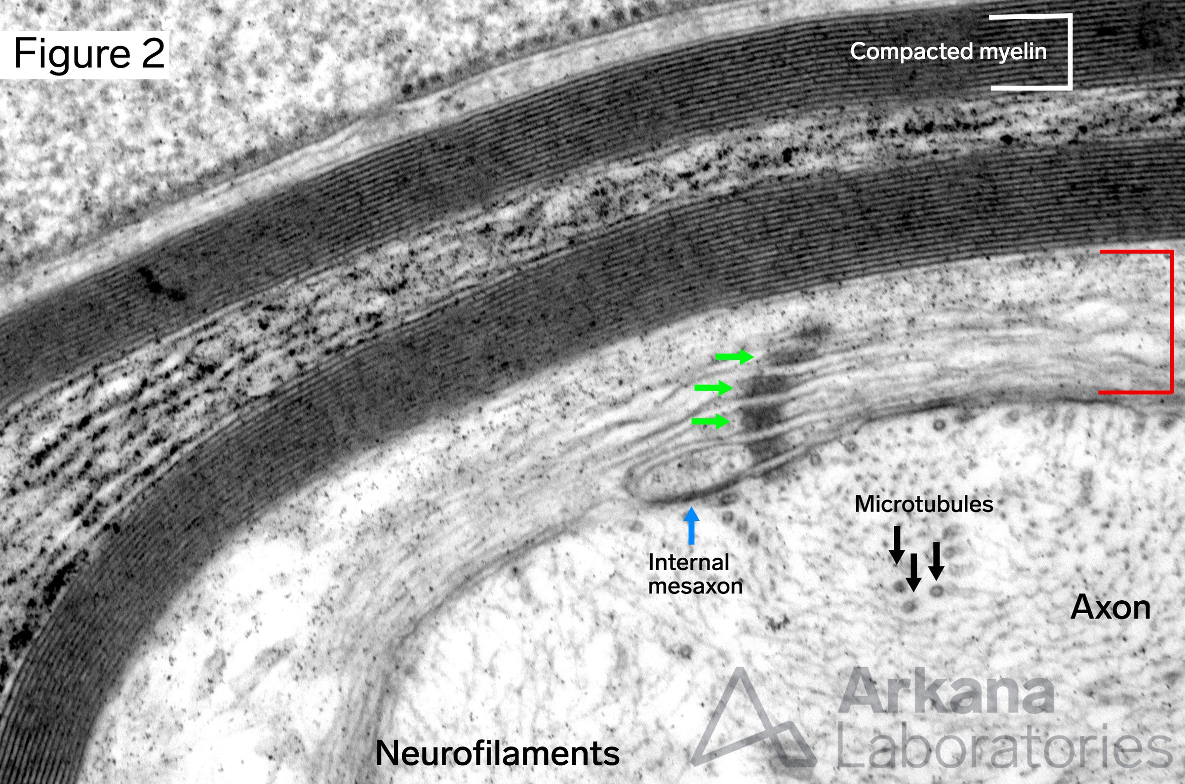axon, Myelin incisure, Schmidt-Lanterman Incisure, myelin sheath