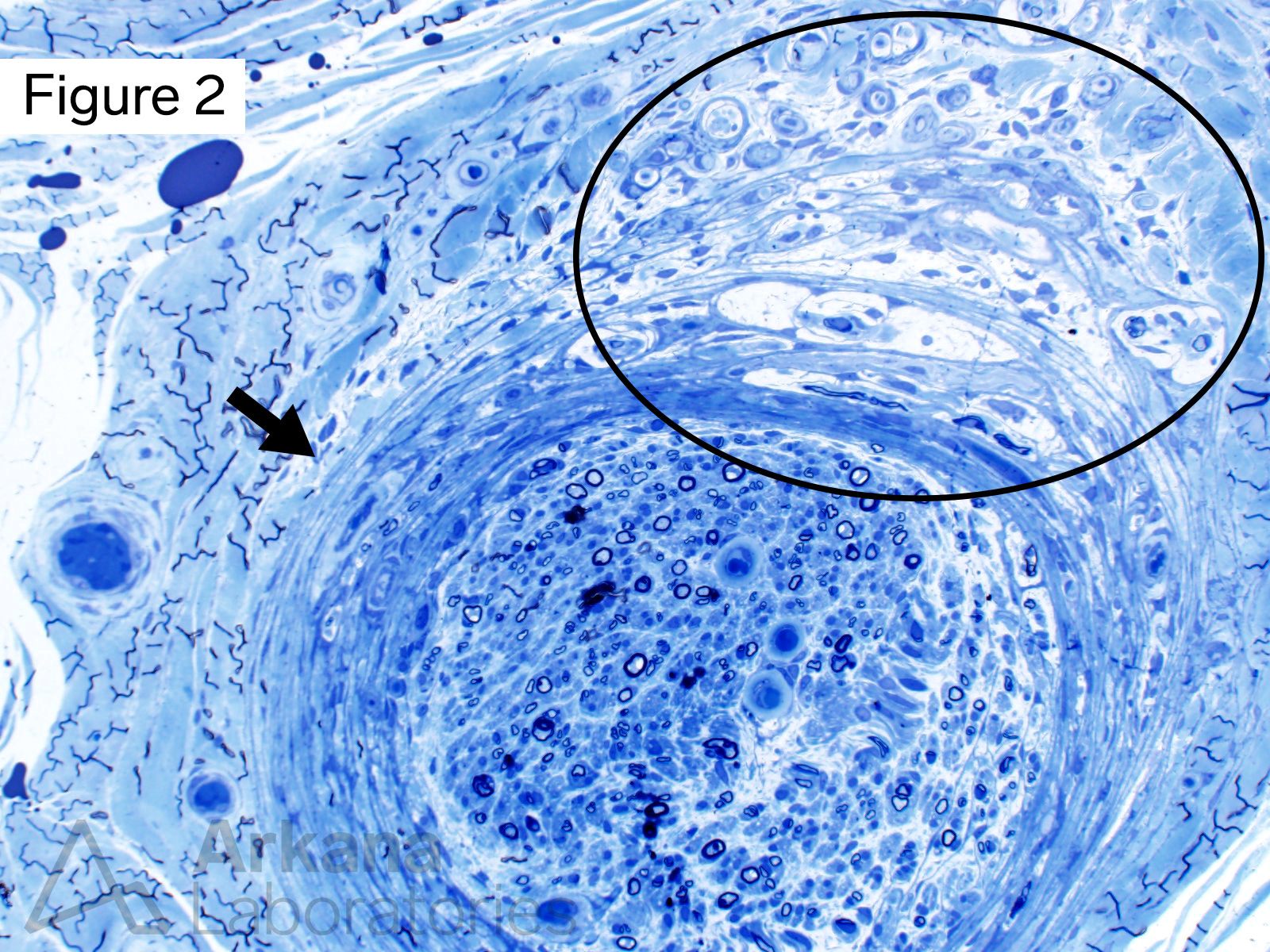 Microfascicles