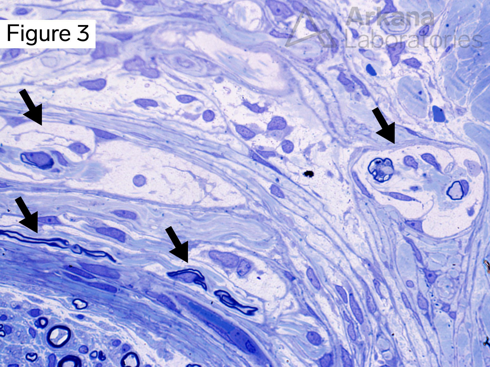 Microfascicles