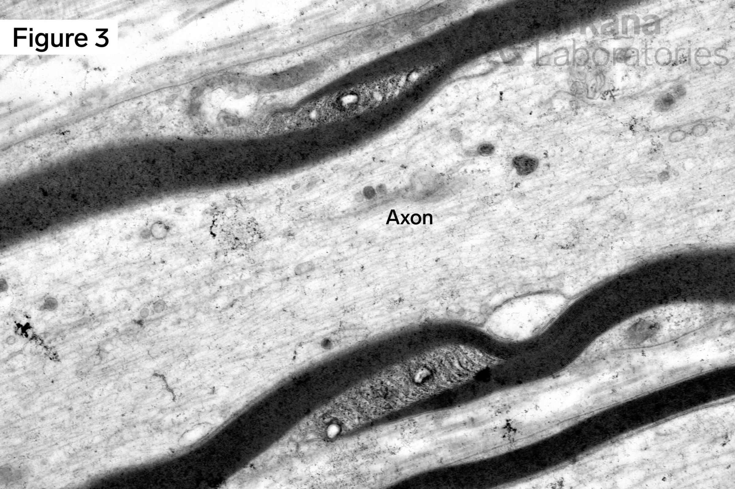 axon, Myelin incisure, Schmidt-Lanterman Incisure, myelin sheath