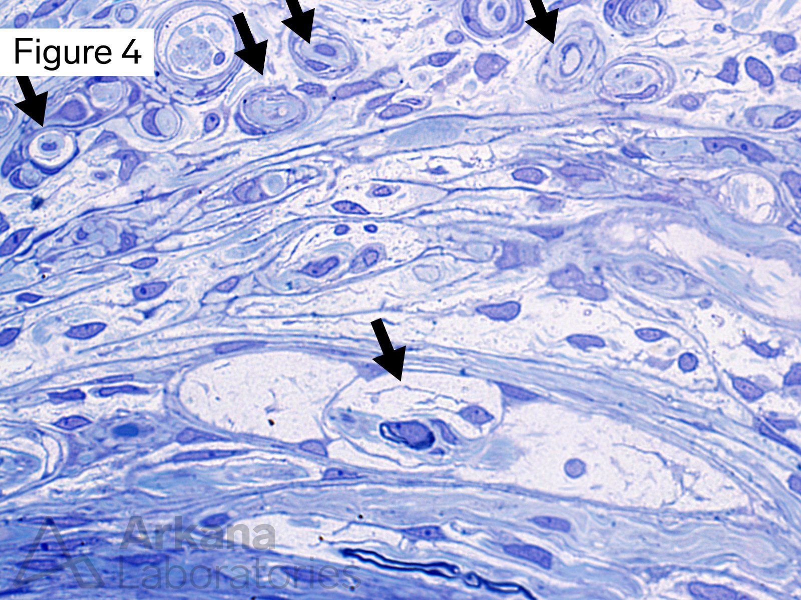 Microfascicles