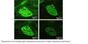 lupus nephritis disease week, arkana laboratories, renal diseases, LN