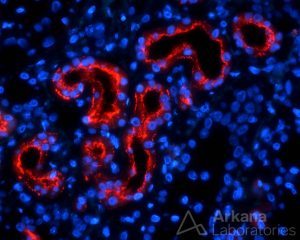 anti-brush border antibody disease