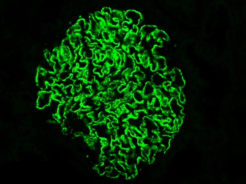 immunofluorescence stain of a kidney biopsy showing a glomerulus