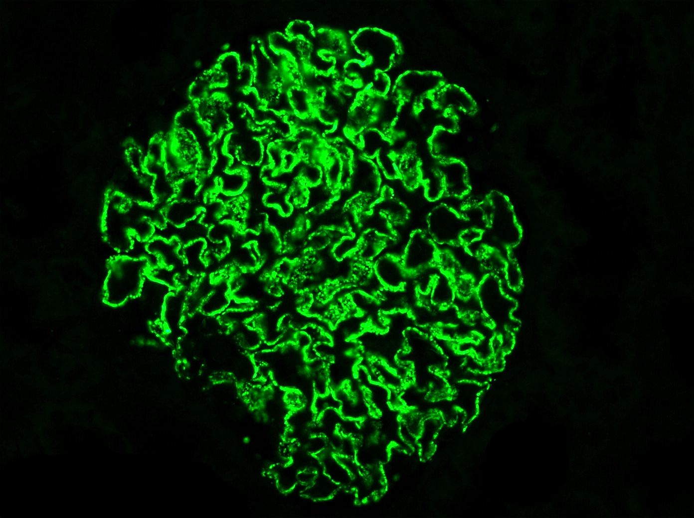 immunofluorescence stain of a kidney biopsy showing a glomerulus