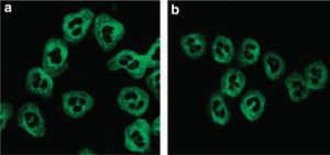 ANCA-associated Vasculitis (AAV), Disease week, arkana laboratories