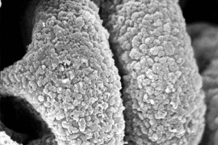 Subepithelial Immune Deposits