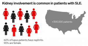 LUPUS NEPHRITIS, SLE, SYSTEMIC LUPUS ERYTHEMATOSUS