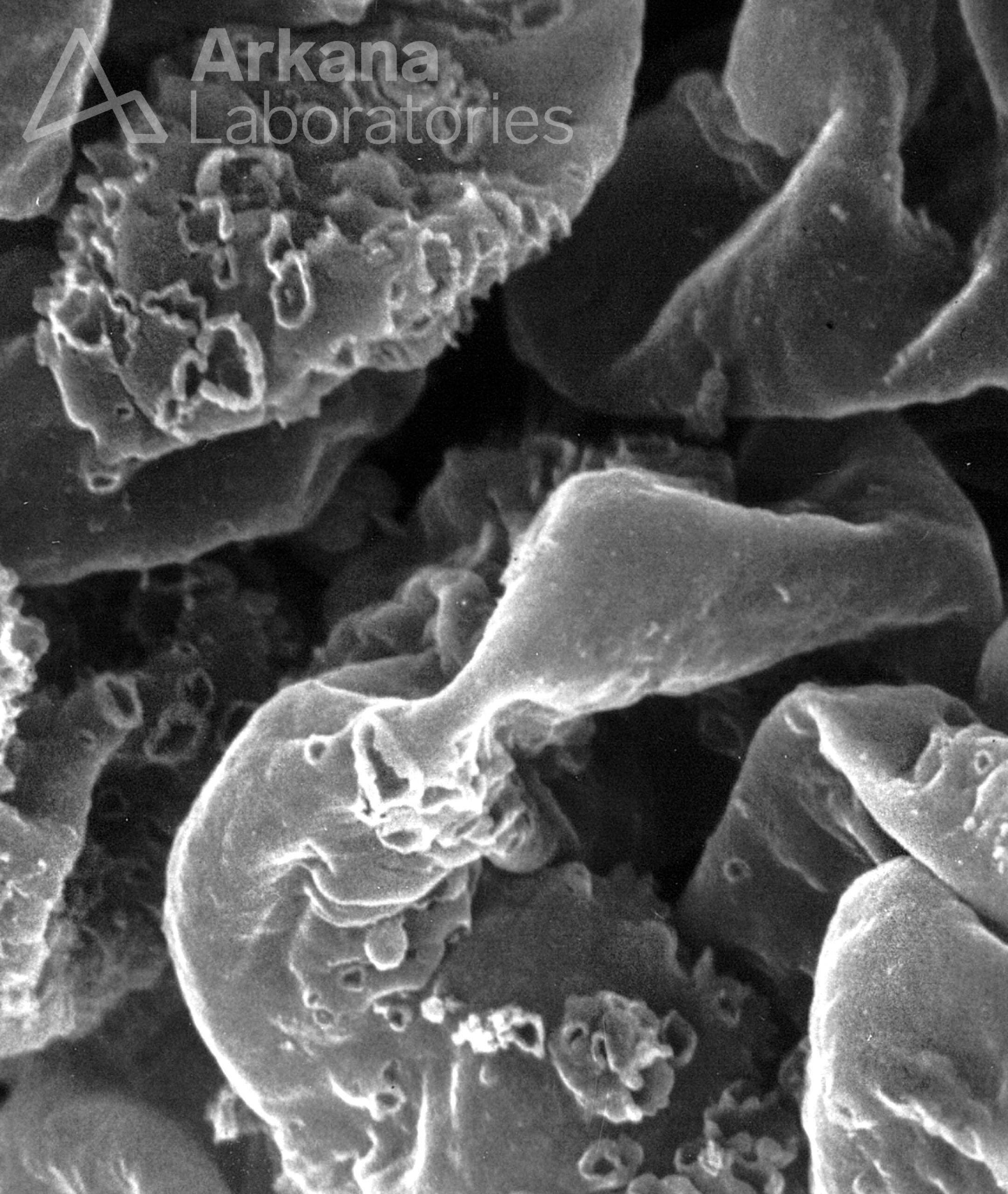 Variability in GBM Formations