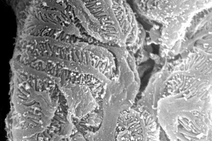 Interdigitating Podocyte Foot Processes