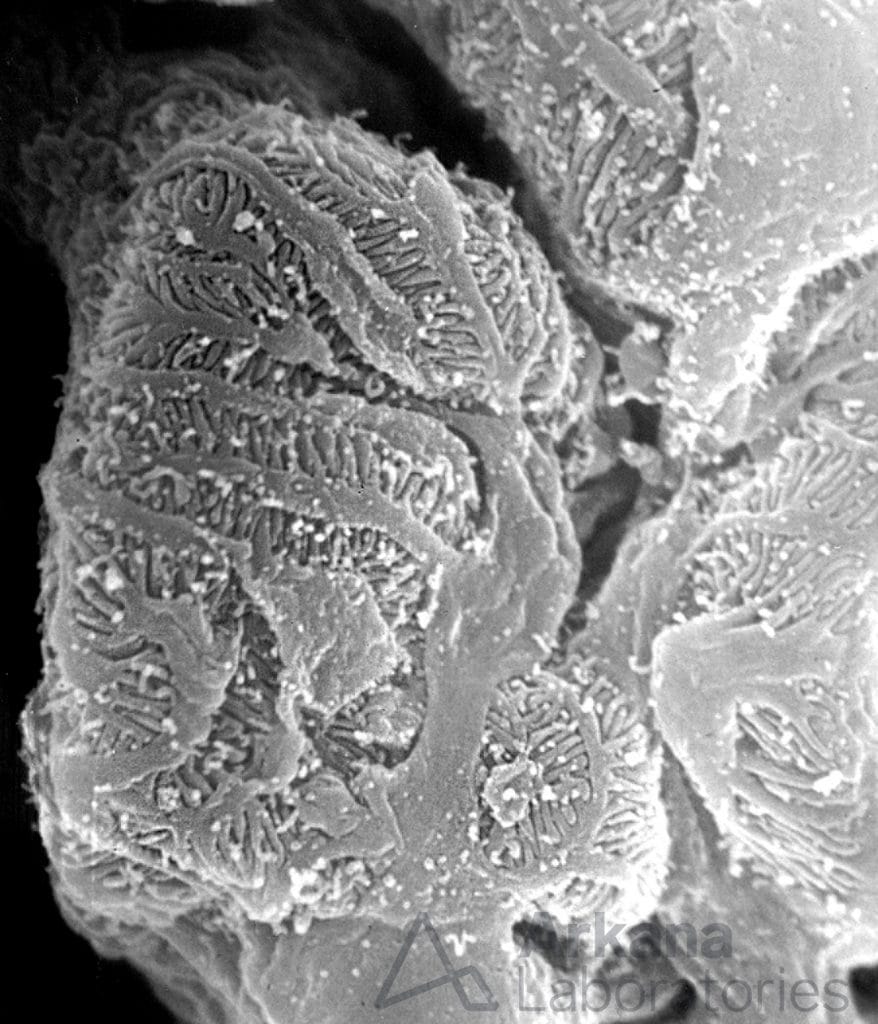 Interdigitating Podocyte Foot Processes | eyeSCANdy | Arkana Labs