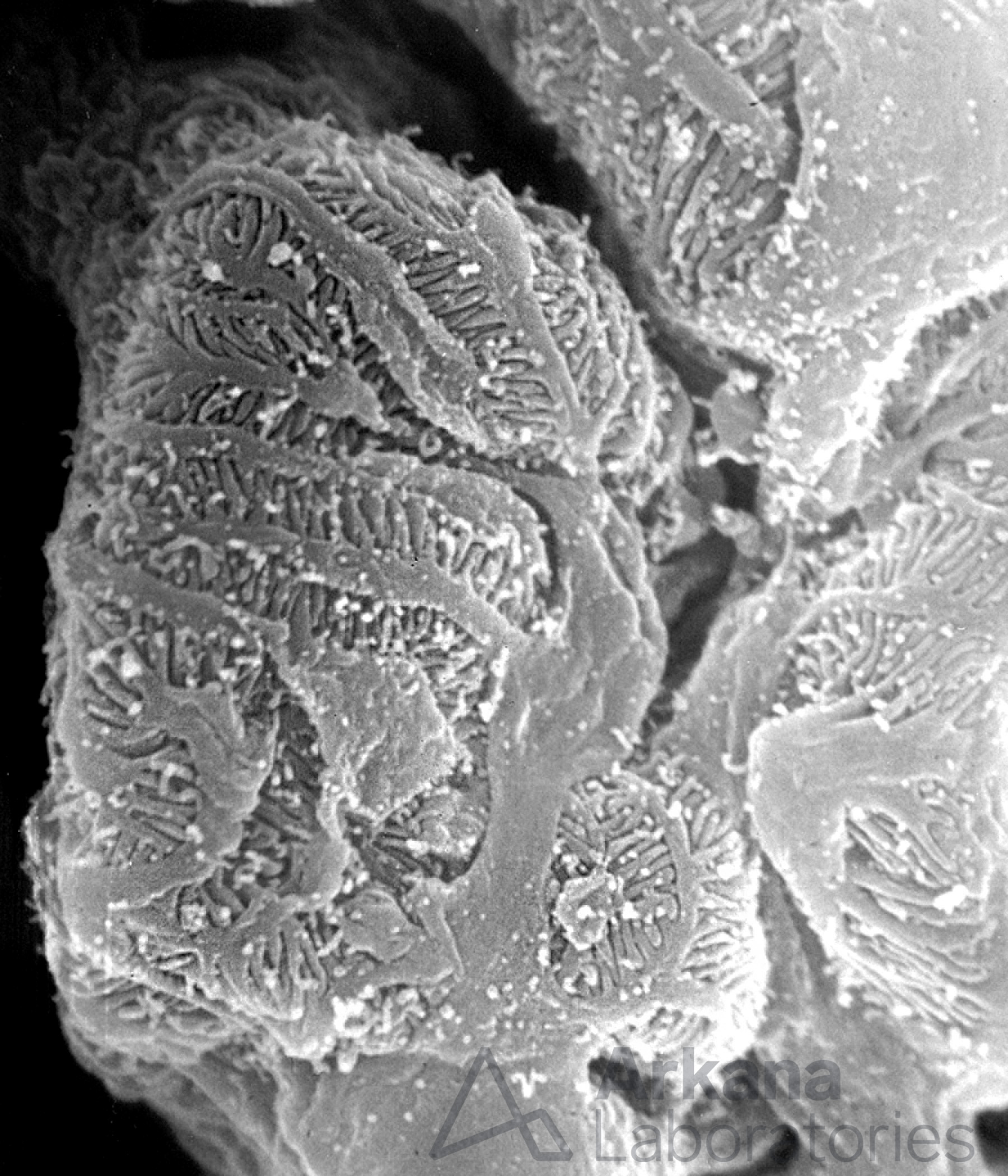 Interdigitating Podocyte Foot Processes