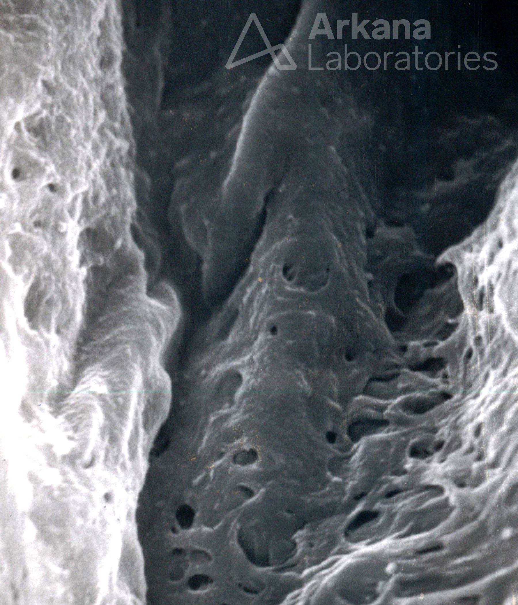 macula densa basement membrane