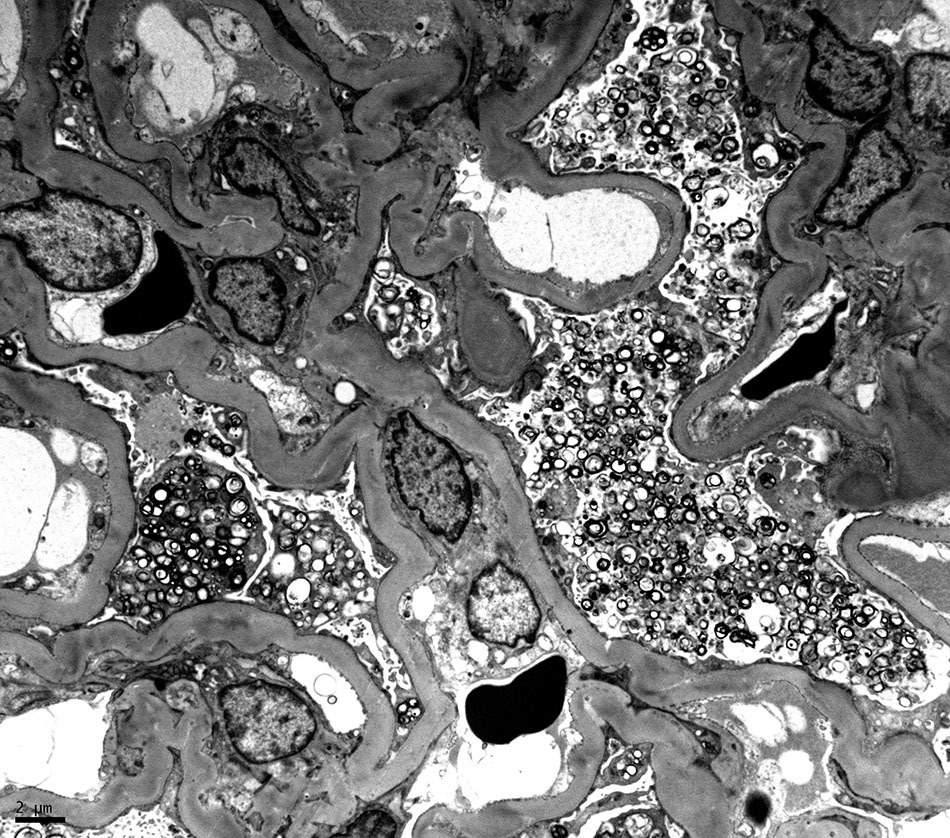 Electron Microscopy quiz for renal pathologists and nephrologists