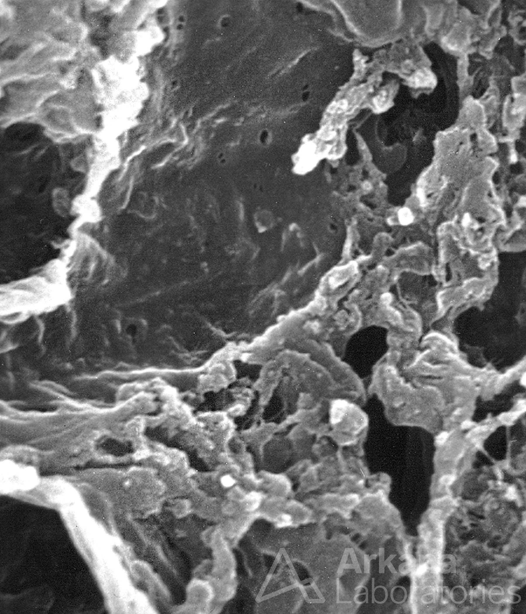 Disintegrating Capillary Loop