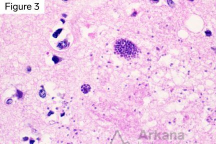 h&E stain showing Toxoplasmosis