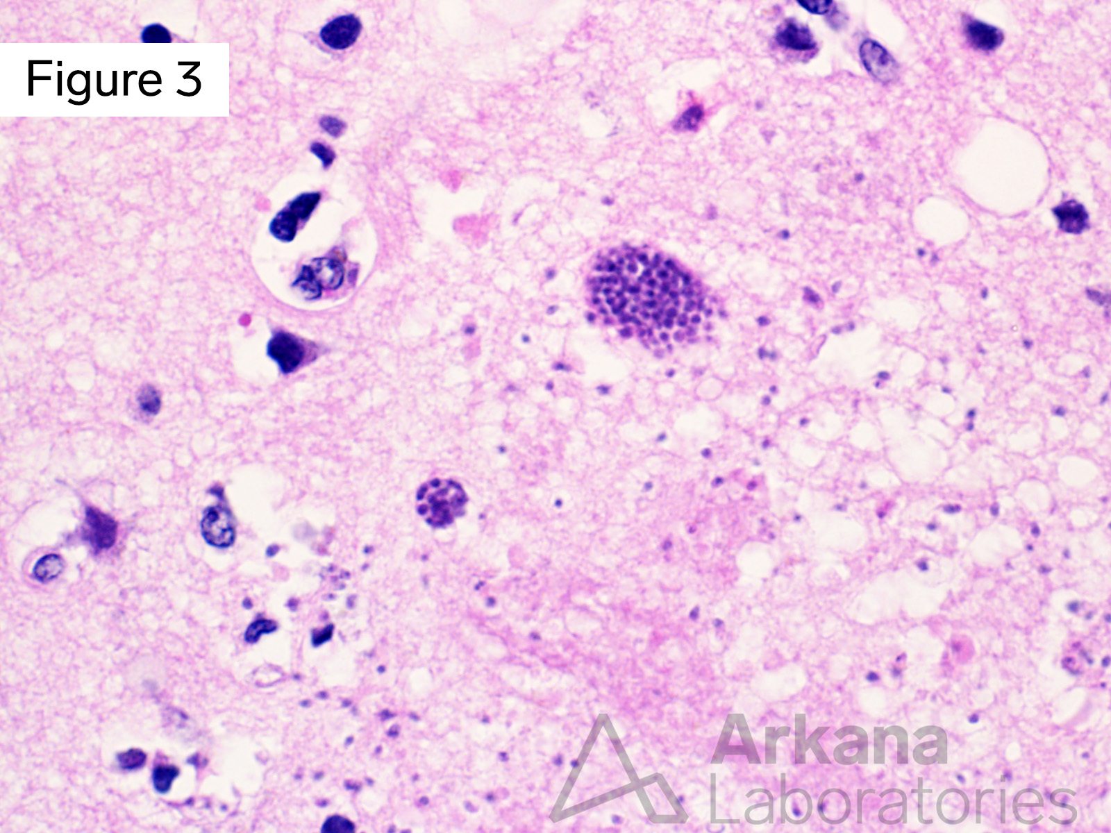 h&E stain showing Toxoplasmosis