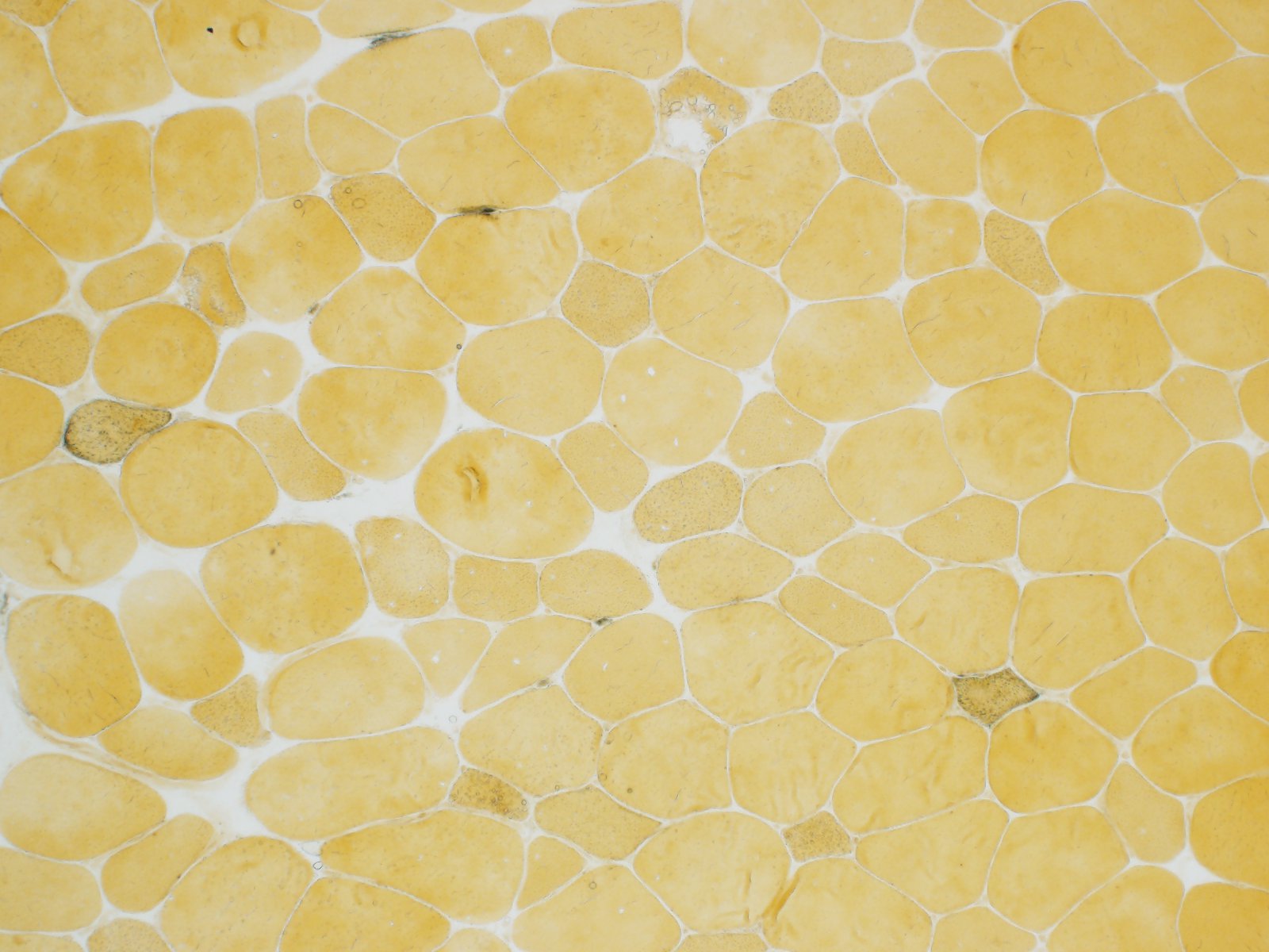diagnostic image of nerve and muscle biopsy sent to arkana laboratories