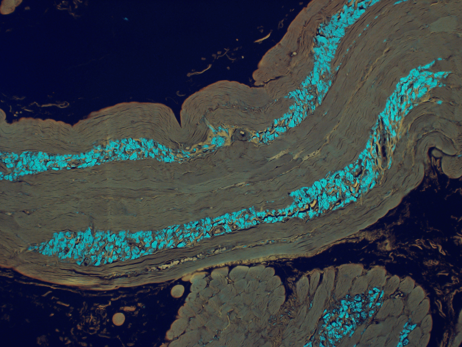 diagnostic image of nerve and muscle biopsy sent to arkana laboratories