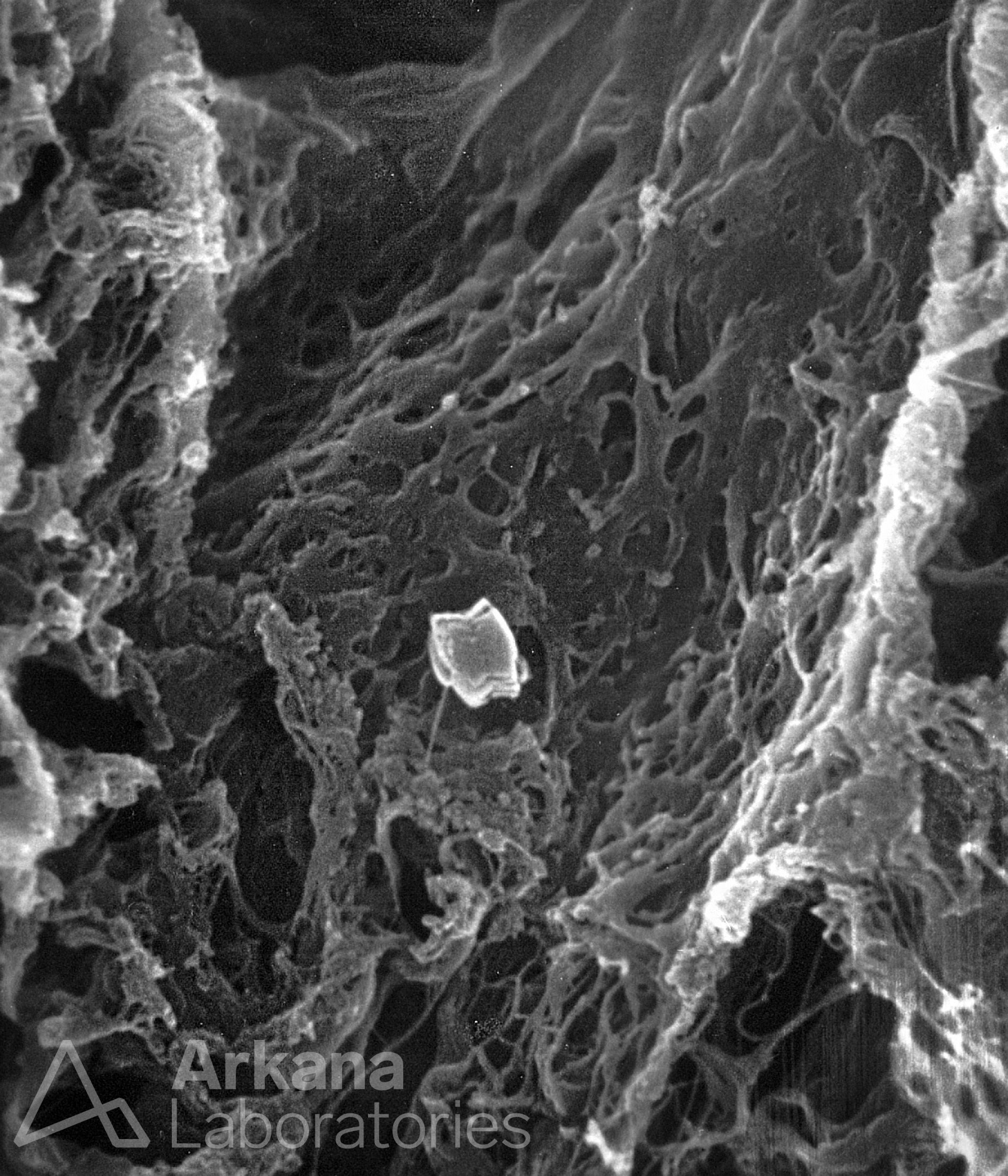 Electron microscopy image showing Macula Densa Basement Membrane Tunnels