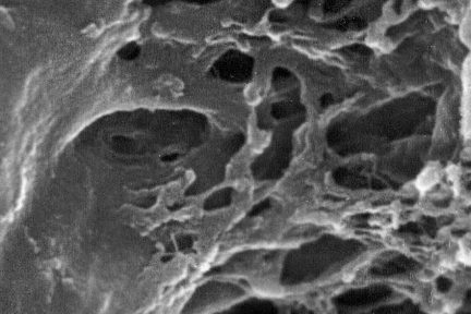 Macula Densa Epithelium, macular densa, juxtaglomerular apparatus, vascular pole