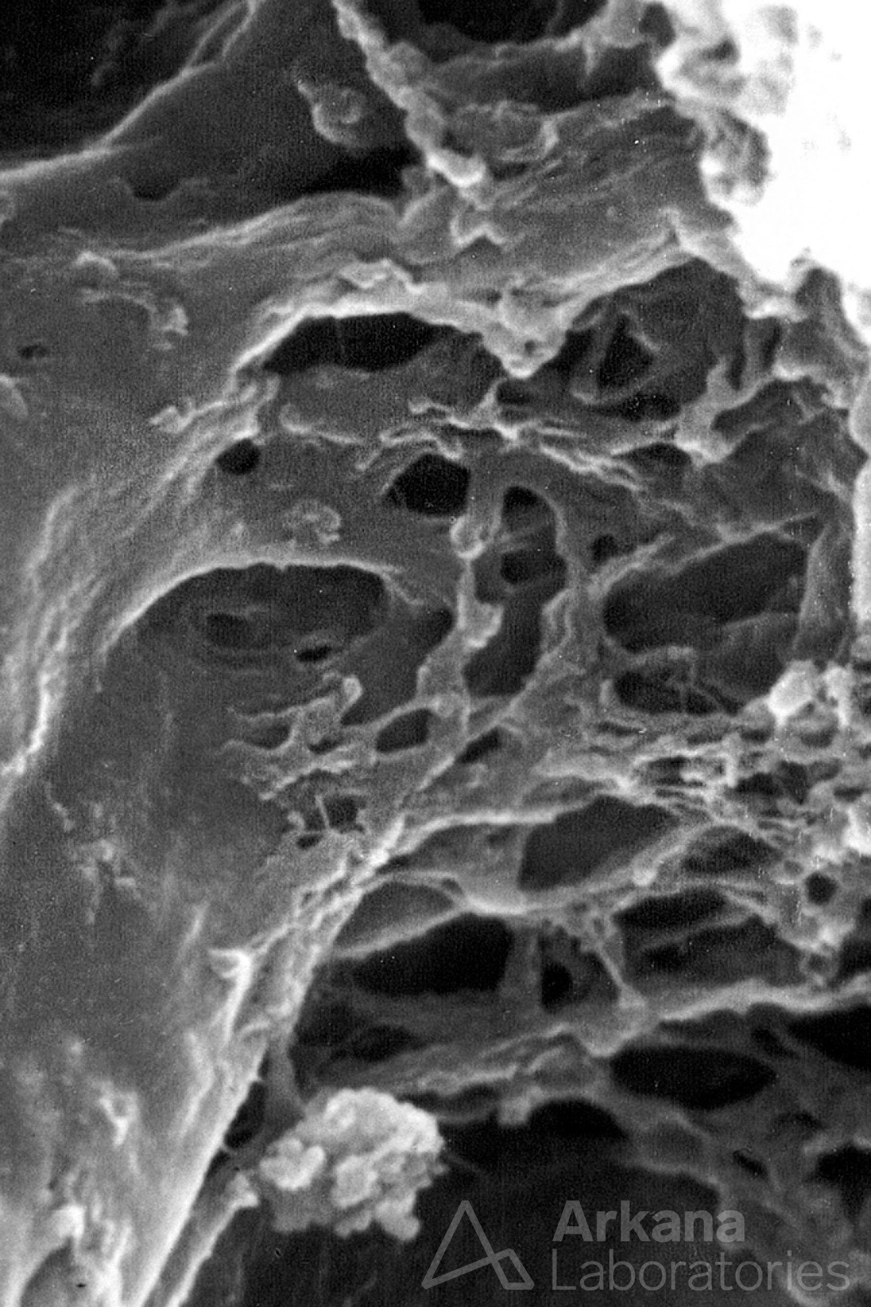 Macula Densa Epithelium, macular densa, juxtaglomerular apparatus, vascular pole