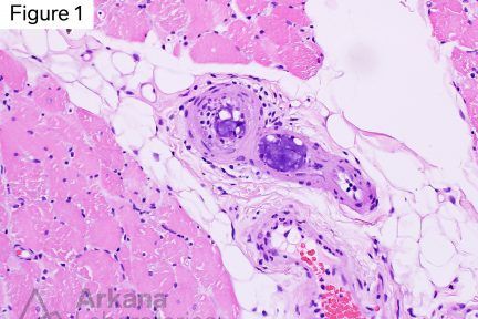 two small arteriole profiles within the perimysium which contain intravascular material