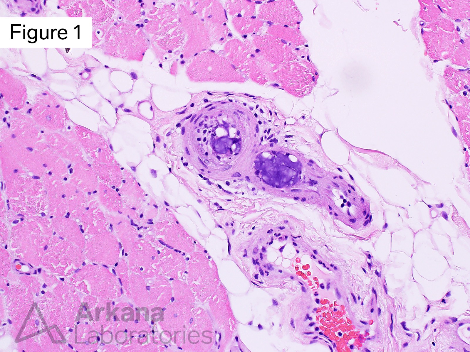 two small arteriole profiles within the perimysium which contain intravascular material