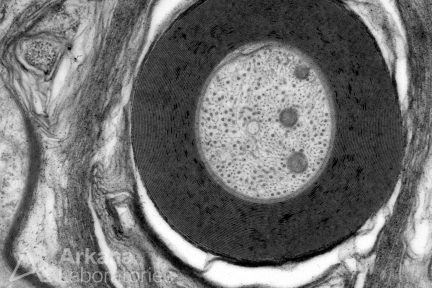 Peripheral Nerve Axon with Microtubules