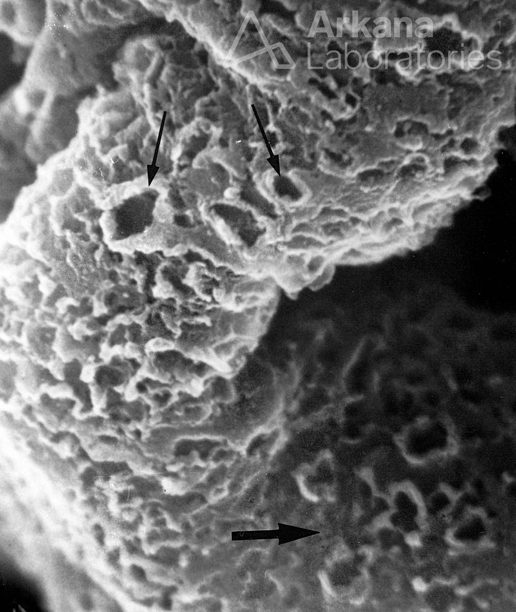 EM image of Glomerular Basement Membrane With A Reticular Appearance And Occasional "Craters"