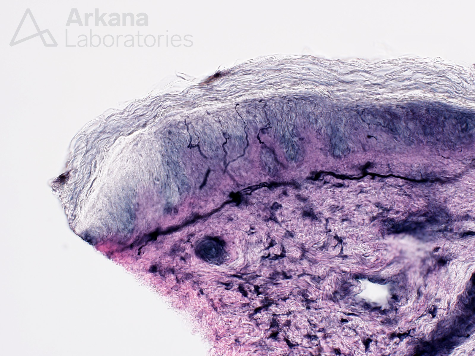 nerve fibers in skin biopsy