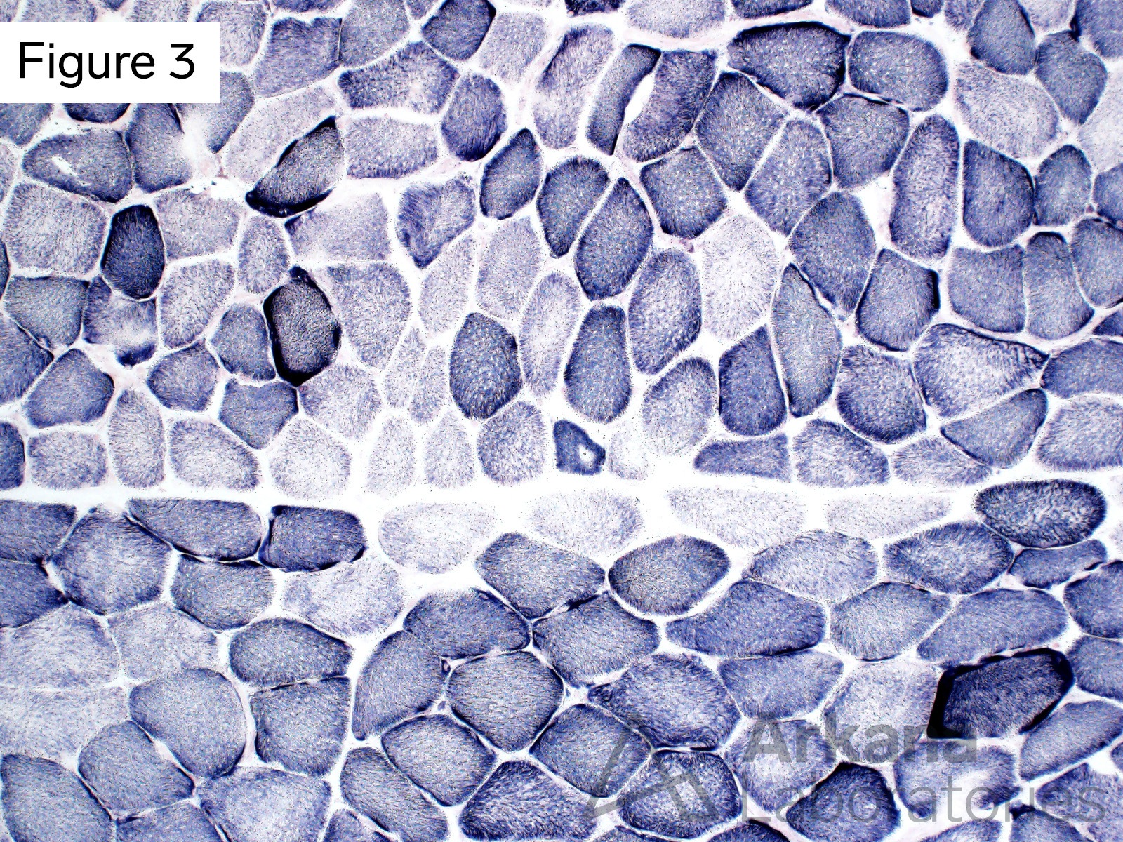 Scattered muscle fibers