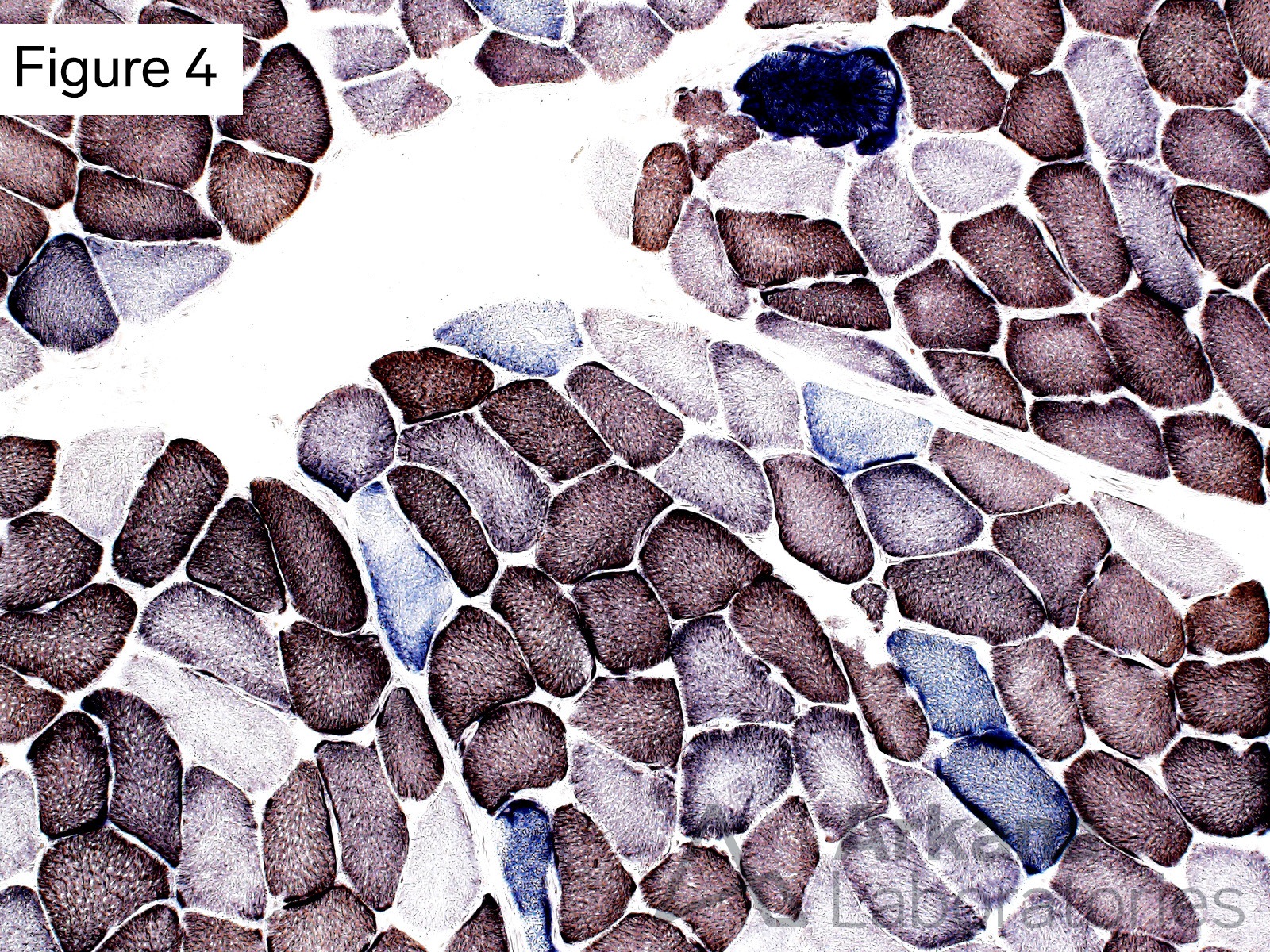 COX is encoded for by mitochondrial DNA