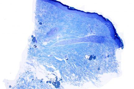 Toluidine blue showing NOTCH3