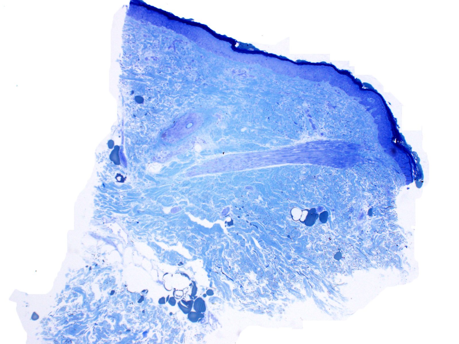 Toluidine blue showing NOTCH3