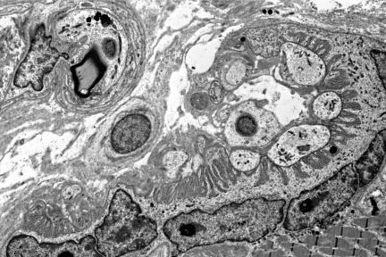 Neuromuscular Junction