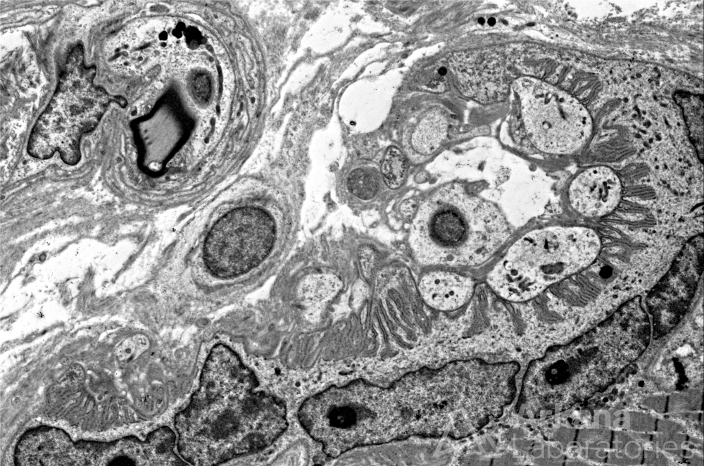 Neuromuscular Junction