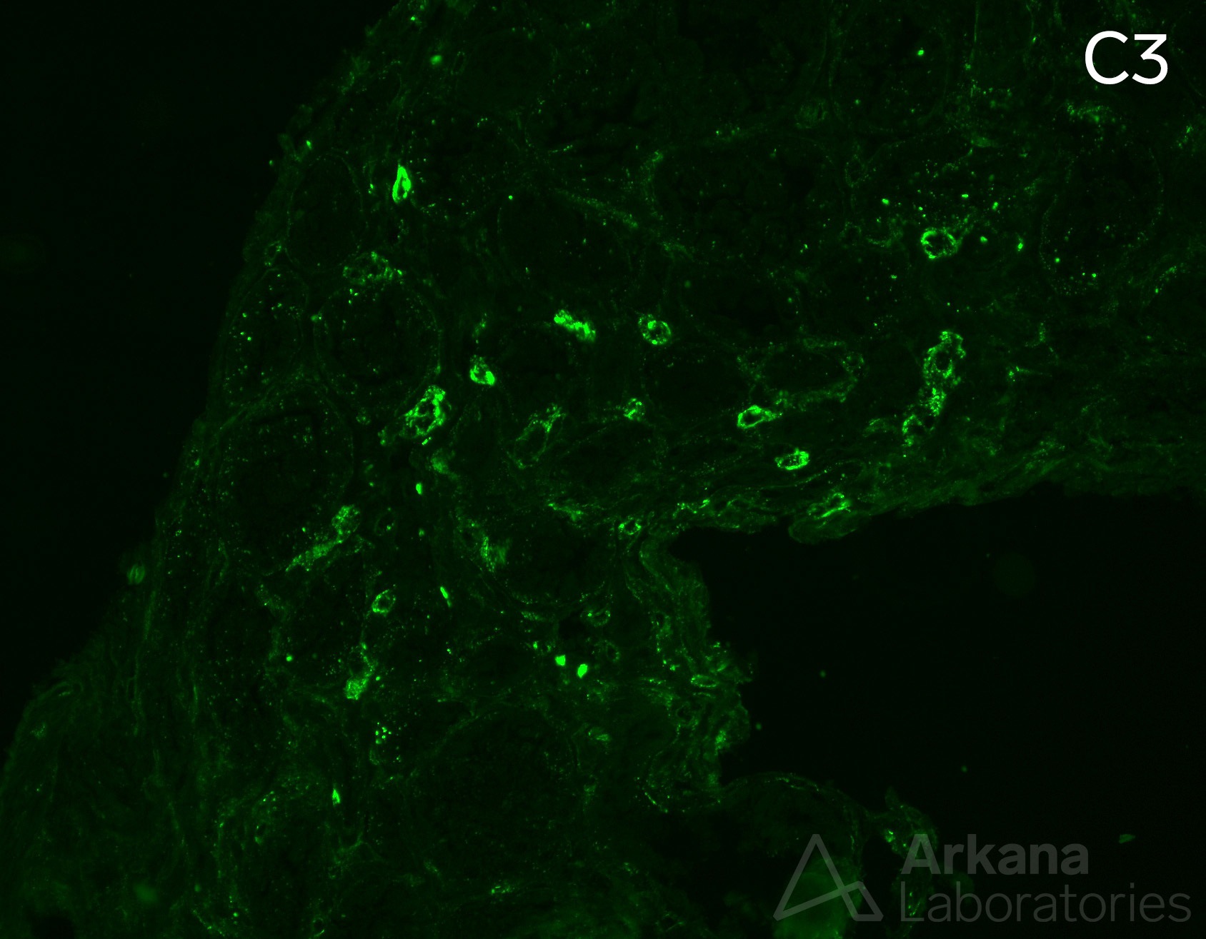 peritubular capillary staining for C3