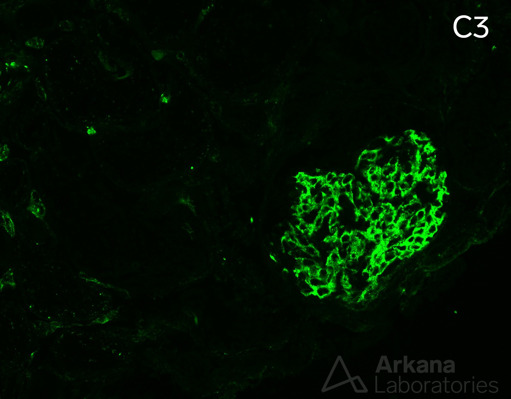 peritubular capillary staining for C3